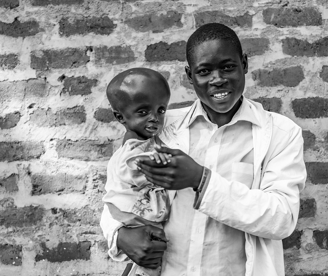 Man holding orphan baby with disabilities