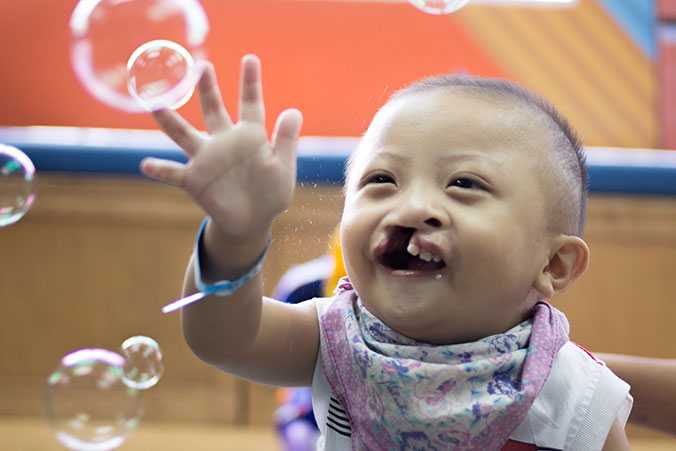 Baby girl with disabilities